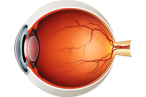 Managing Vitreous Disorders Insights And Treatment Strategies