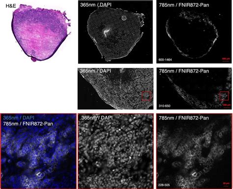 Ex Vivo Histological Validation Of Tumor Labeling After I V Injection