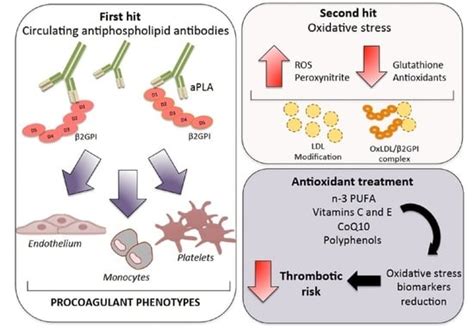 Antioxidants Free Full Text Oxidative Stress In The Pathogenesis Of