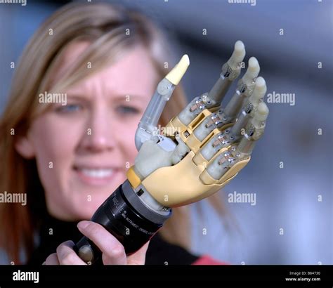 Bionic Hands For Amputees Each Digit Can Move Stock Photo Alamy