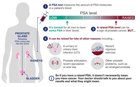 Is there an increased risk of prostate cancer with taking testosterone replacement therapy ...