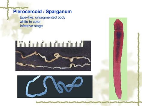 Ppt Spirometra Mansoni Powerpoint Presentation Free Download Id