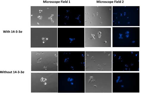 Author Correction 14 3 3σ is required to prevent mitotic catastrophe