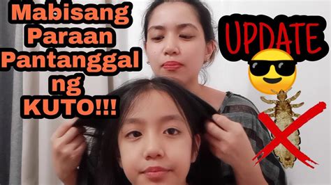 Mabisang Paraan Pantanggal Ng Kuto At Lisa Update Youtube