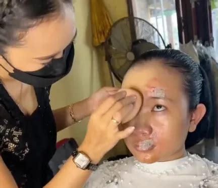 Wajah Pengantin Hancur Akibat Kecelakaan Riasan MUA Jadi Penyelamat