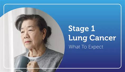 Stage 1 Lung Cancer: What To Expect | MyLungCancerTeam