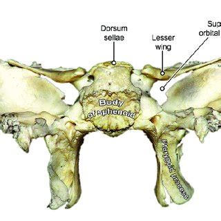 Sphenoid bone (extracted) -view from lateral. | Download Scientific Diagram