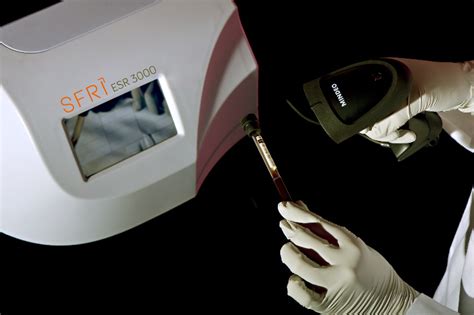 ESR 3000 : Hematology Range SFRI