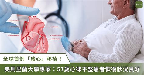 全球首例「豬心」移植！美馬里蘭大學專家：57 歲心律不整患者恢復良好 Heho健康