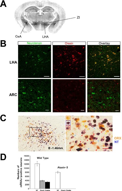 Figure 1 From Neurotensin Co Expressed In Orexin Producing Neurons In