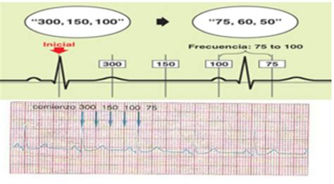 C Mo Calcular La Frecuencia Y Ritmo Card Aco