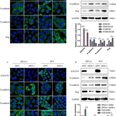 Galnt6 Promotes Emt In Lung Adenocarcinoma Cells A549 H1299 Spca 1