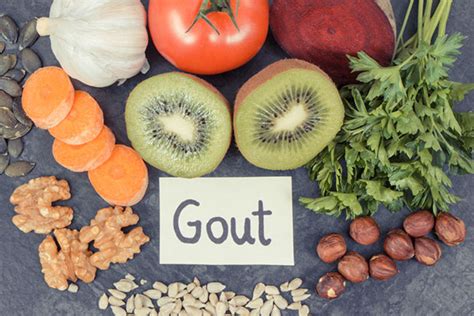 Which Foods Cause Gout Dr Naveen Bhadauria Private Rheumatologist Consultant In London