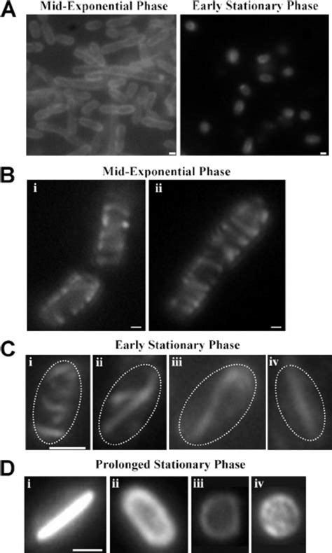 Localization Of Yfp Mreb In Exponential And Stationary Phase Cells Of