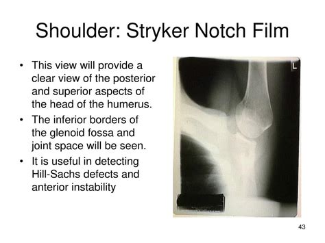 Ppt 141 Shoulder Radiography Powerpoint Presentation Free Download