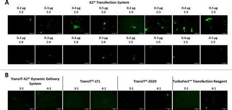 Comparison Of Transfection Efficiency Between Commercial Transfection