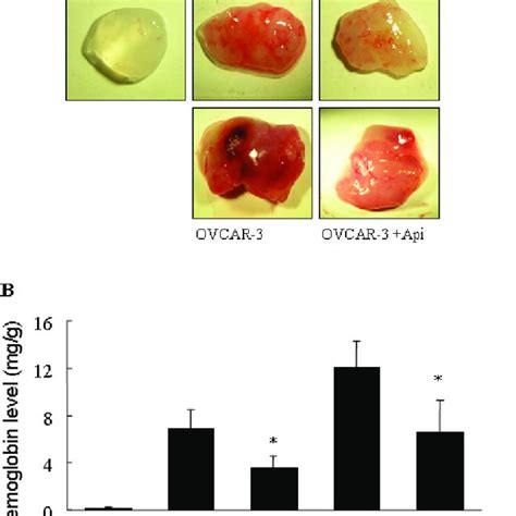 Apigenin Inhibited Tumor Angiogenesis In Nude Mice Model PC 3 And