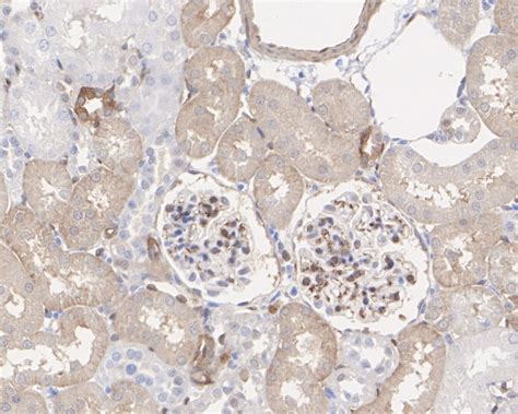 Phospho Yap S Recombinant Rabbit Monoclonal Antibody Sn E