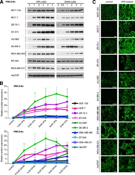 PMCA4b Expression Is Selectively Regulated During HDAC Inhibitor