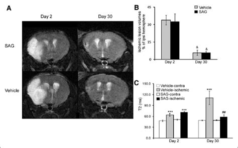 A Representative T Weighted Images Of Sonic Hedgehog Pathway Agonist