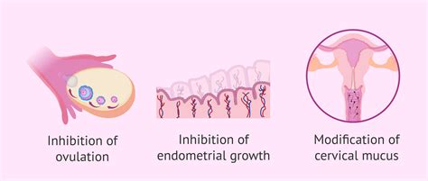 Mechanism of action of birth control implant