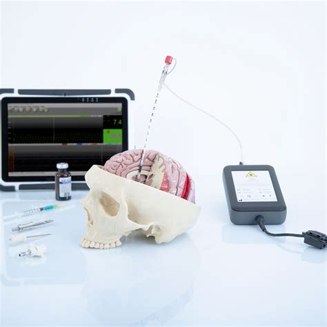 Bedside cerebral blood flow measurement | CARAG AG