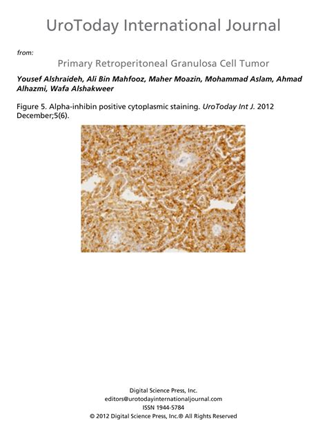 Primary Retroperitoneal Granulosa Cell Tumor