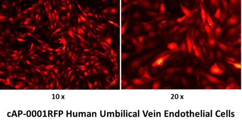 Rfp Expressing Human Umbilical Vein Endothelial Cells Angio Proteomie