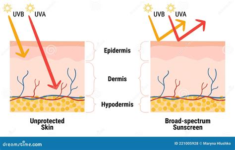 Uv Penetration Into The Layers Of The Skin Infographic Of Sunscreen