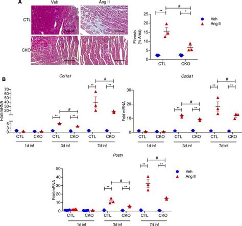 Jci Insight Camkiiδ Mediated Inflammatory Gene Expression And Inflammasome Activation In