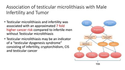 Testicular Microlithiasis Pptx