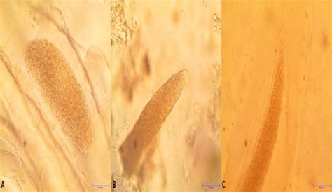 Microscopic Determination Of Sarcocystis Microscyst A S Cruzi B S Download Scientific