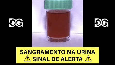 Sangramento Na Urina Sinal De Alerta Youtube