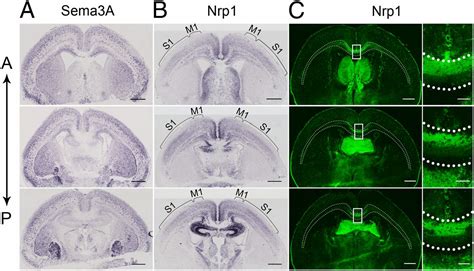 Axon Position Within The Corpus Callosum Determines Contralateral