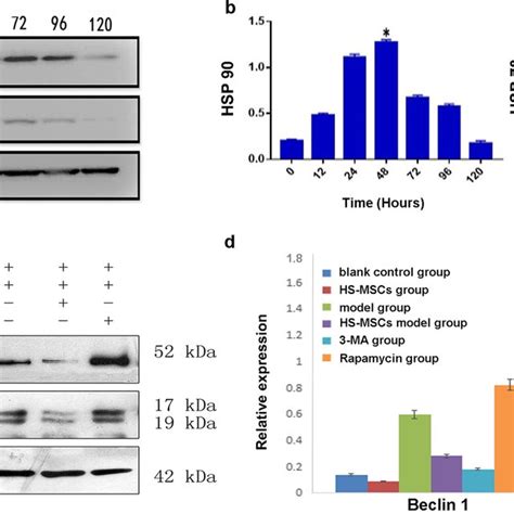 Expressions Of Heat Shock Proteins And Autophagy Related Markers In