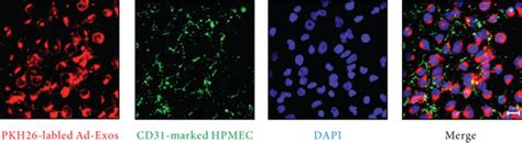 Adipocyte Derived Exosomal Mirna 122 5p Reinforces The Pulmonary