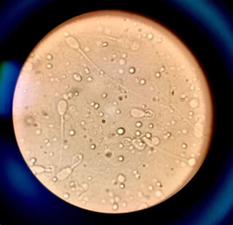 Dormitorio Derivaci N Perro Espermatozoides Microscopio Optico M Xima