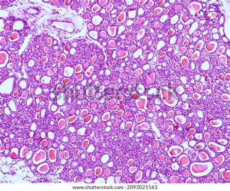 Thyroid Follicles Cat Thyroid Gland This Stock Photo 2093021563 ...