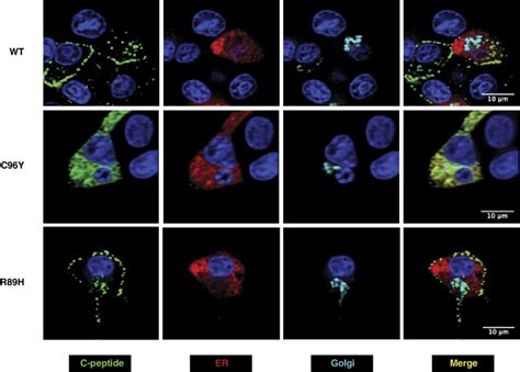 Subcellular Localization Of Wild Type WT And Mutant Human Proinsulin