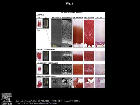 3d Histopathological Grading Of Osteochondral Tissue Using Contrast