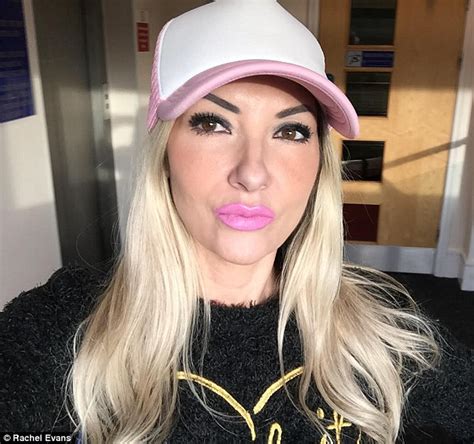 Mum Spent £20000 On Botox Breast Implants And Fillers To Look Like