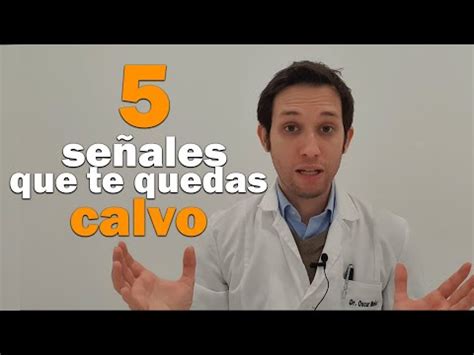 Descubre los 5 signos clave de la calvicie masculina Cómo saber si te