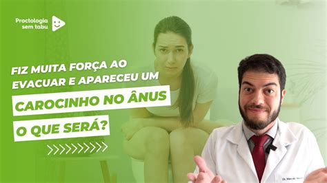 Caroço Bolinha Dura E Escura No Anus O Que Pode Ser🌝 Descubra Um