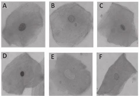 Photomicrographs Of Cells Exfoliated From The Oral Mucosa Stained