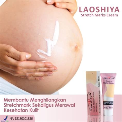 Penghilang Bekas Tanda Melahirkan Stretch Mark Cream Laoshiya