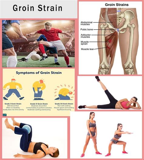 What is Groin Strain