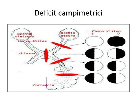 Ppt Loculistica Nella Medicina Durgenza E Le Urgenze Oculistiche