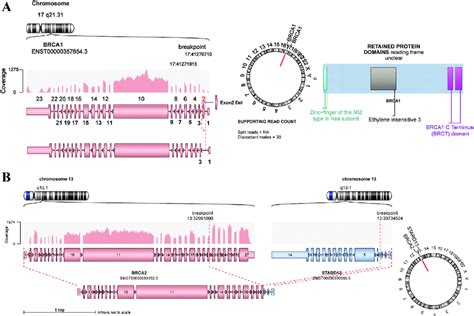 Brca Gene Mutations A A Germline Large Deletion Of Exon 2 In Brca1 Download Scientific