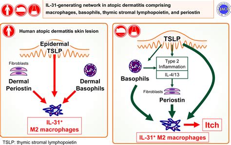 IL 31generating Network In Atopic Dermatitis Comprising Macrophages