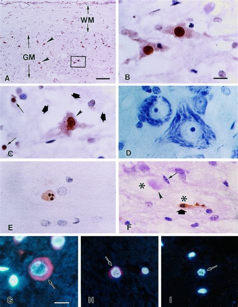 Neuronal And Glial Apoptosis After Traumatic Spinal Cord Injury